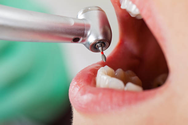 Best Root Canal Emergency Dentist  in Round Rock, TX